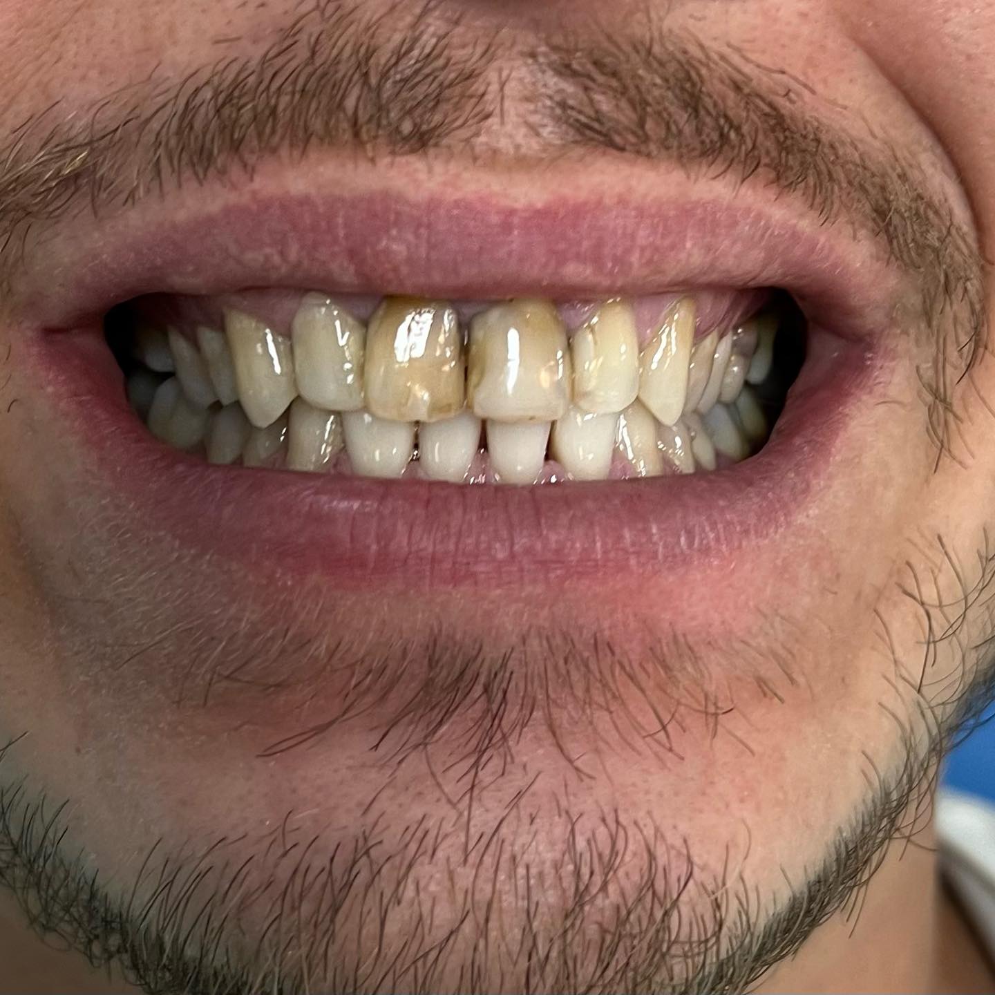 After