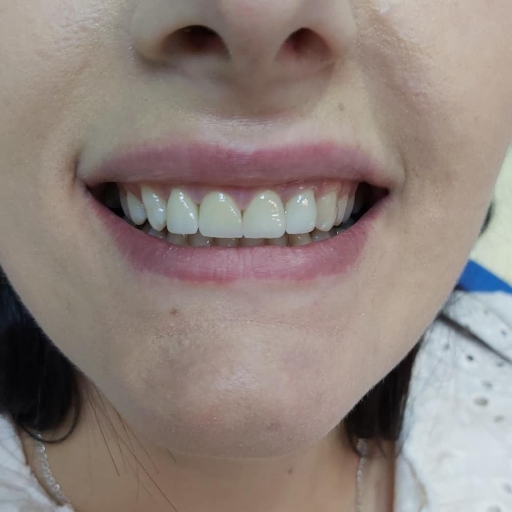 Before